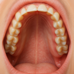 podniebienie gotyckie